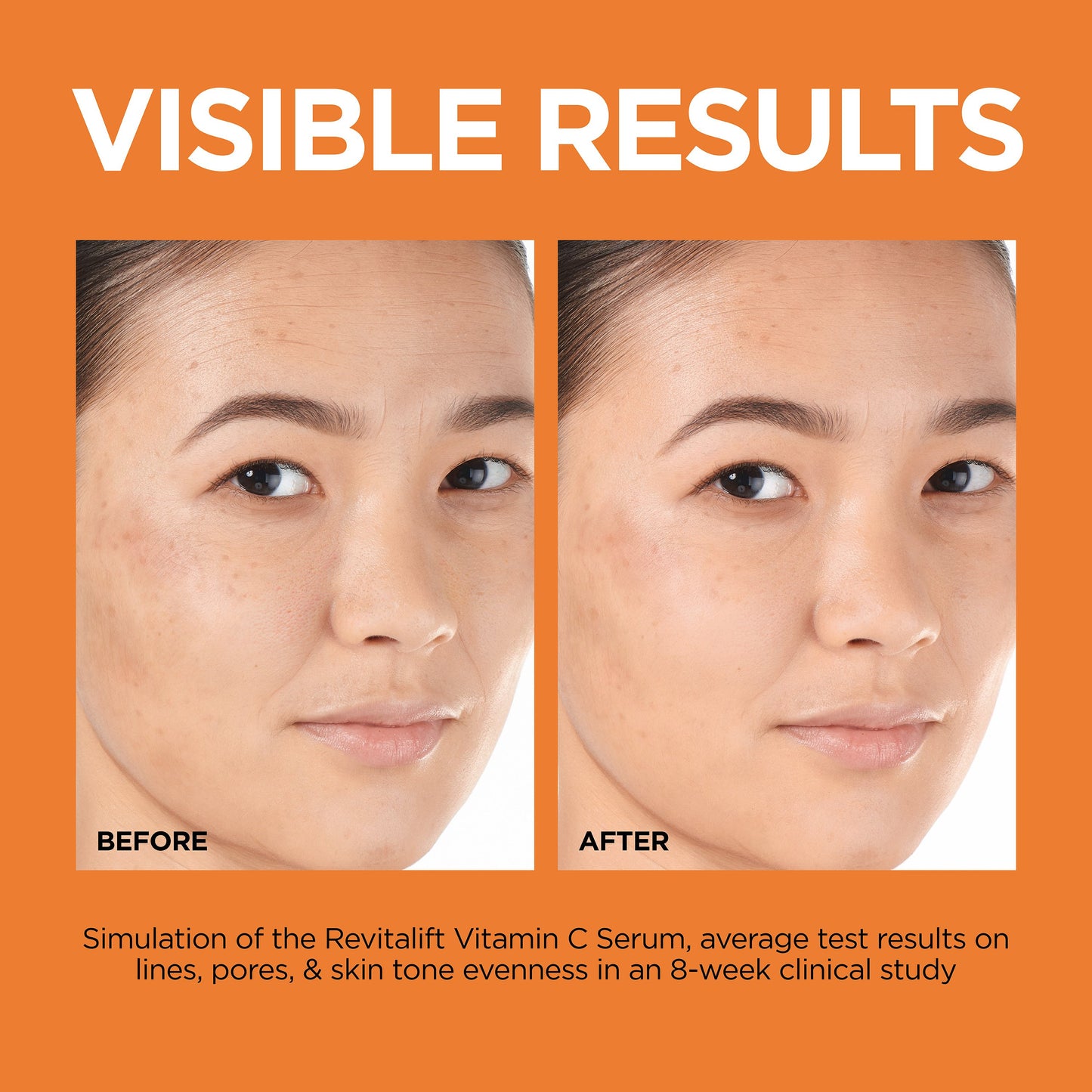 L'Oréal Paris Revitalift Derm Intensives 12% Vitamin C + E + Salicylic Acid Serum