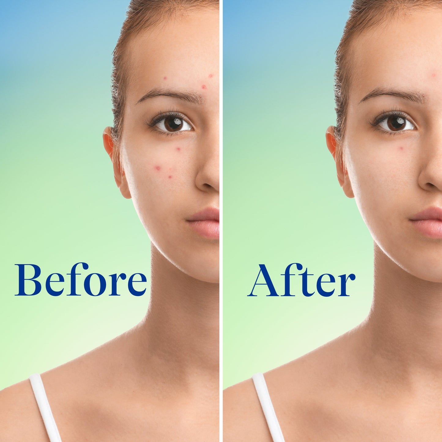 Differin Maximum Strength Acne Foaming Cleanser