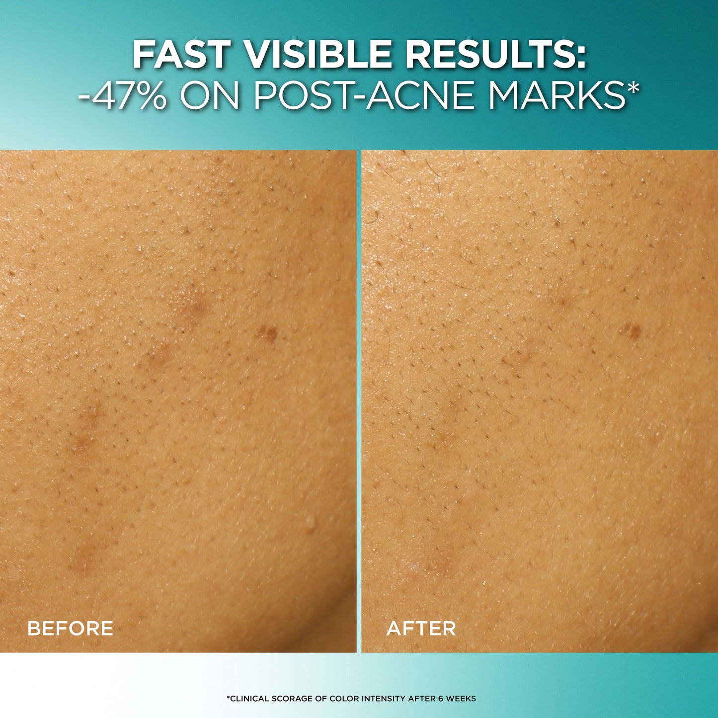 L'Oréal Paris Bright Reveal Dark Spot Exfoliant Peel