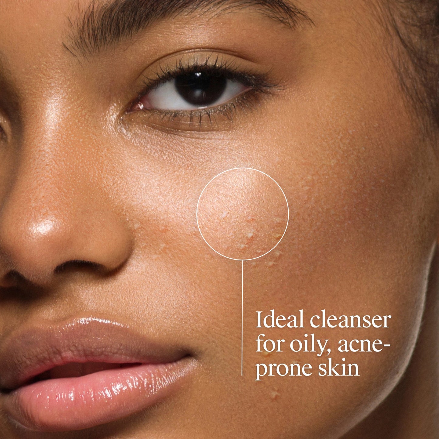 Neutrogena Oil-Free Salicylic Acid Acne Fighting Face Wash