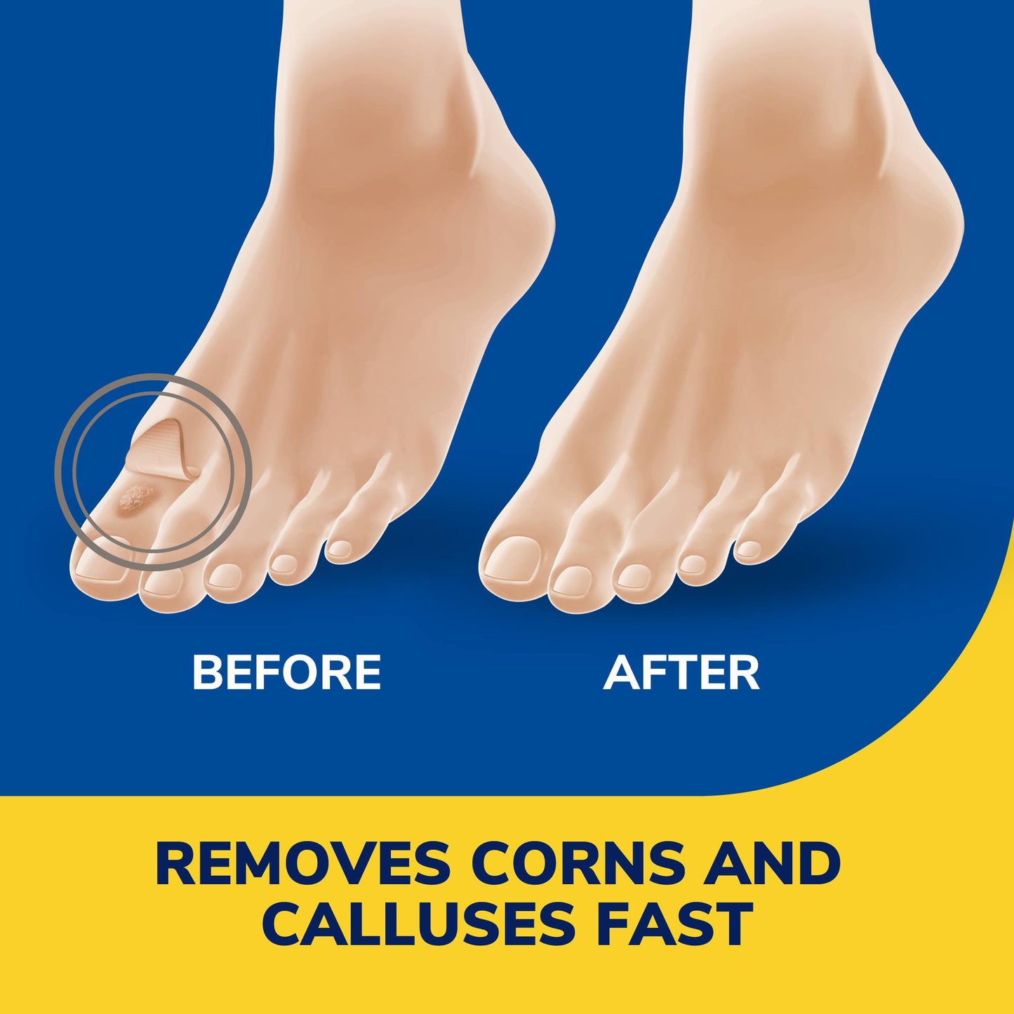 Dr. Scholl's Liquid Corn & Callus Remover