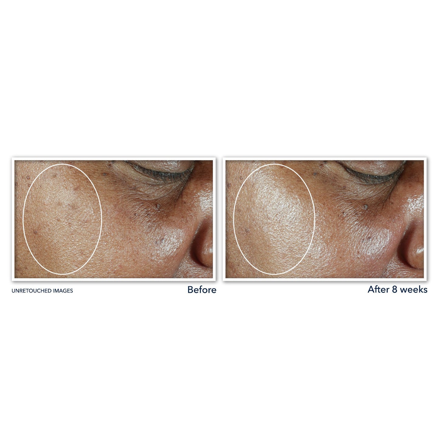 RoC 5-in-1 Daily Moisturizer