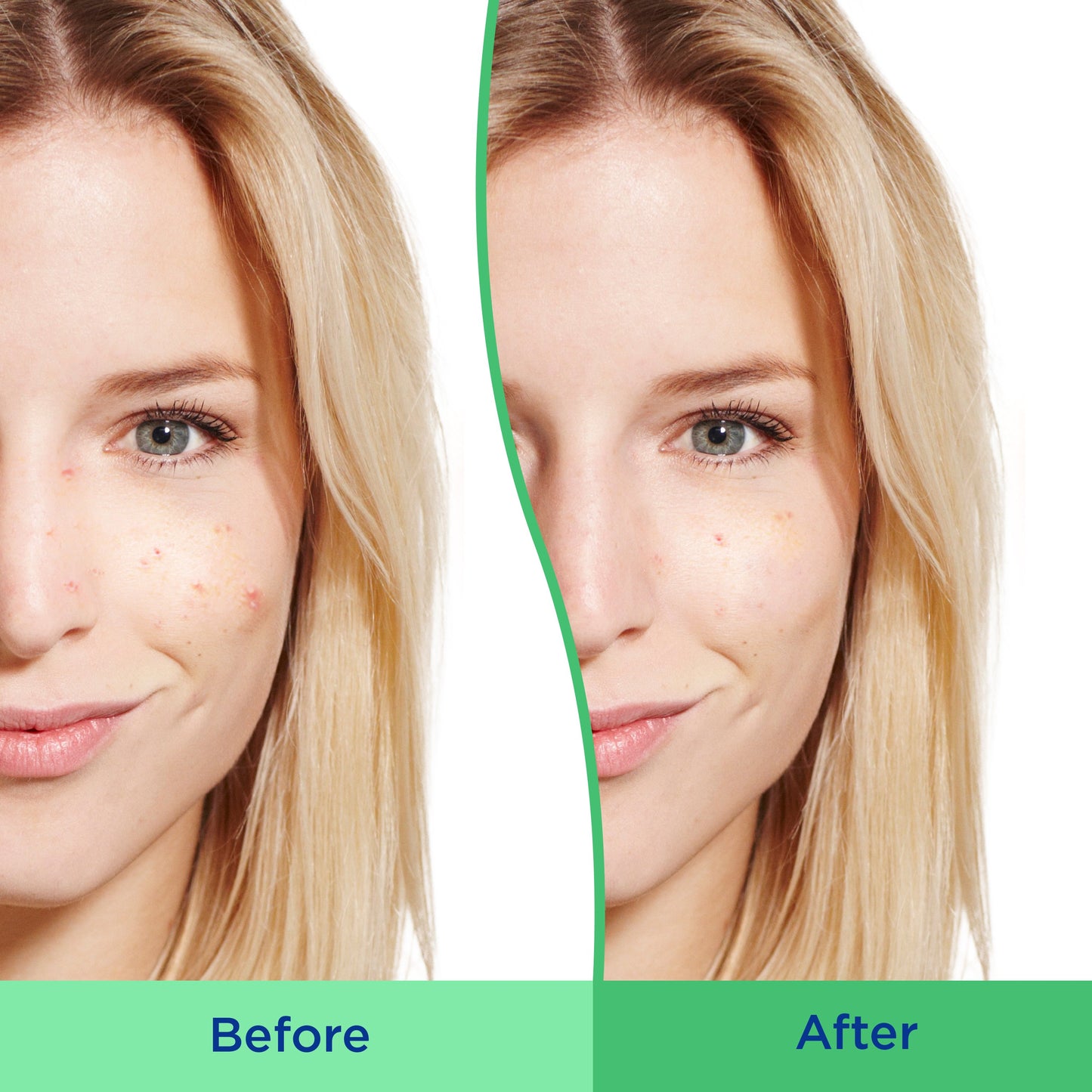 Differin Daily Deep Cleanser