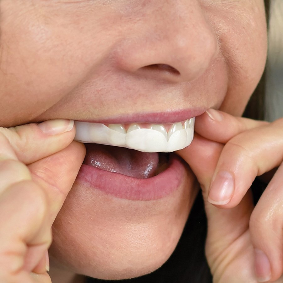 SleepRight ProRx Custom-Fit Dental Guard