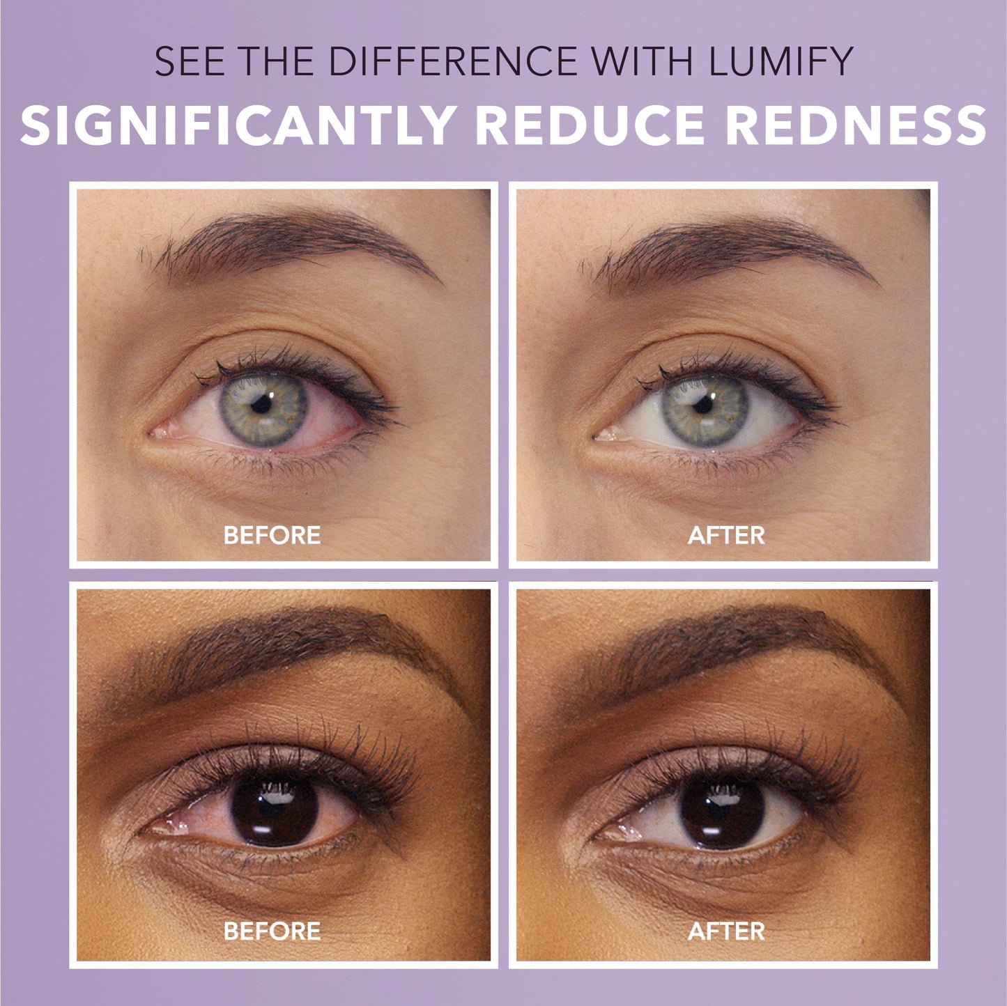 Bausch & Lomb Lumify Redness Reliever Eye Drops