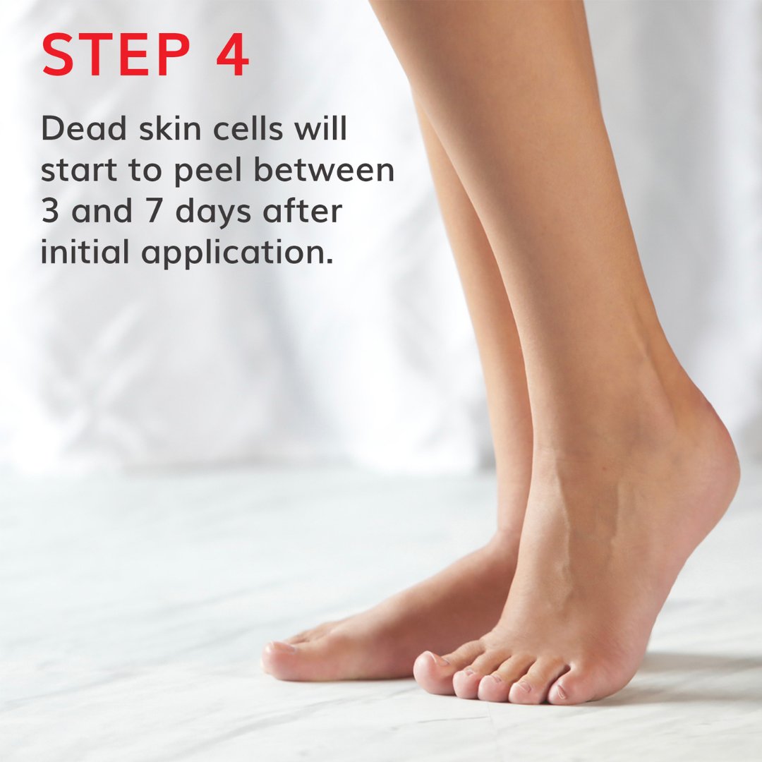 Baby Foot Exfoliation Foot Peel - Lavender