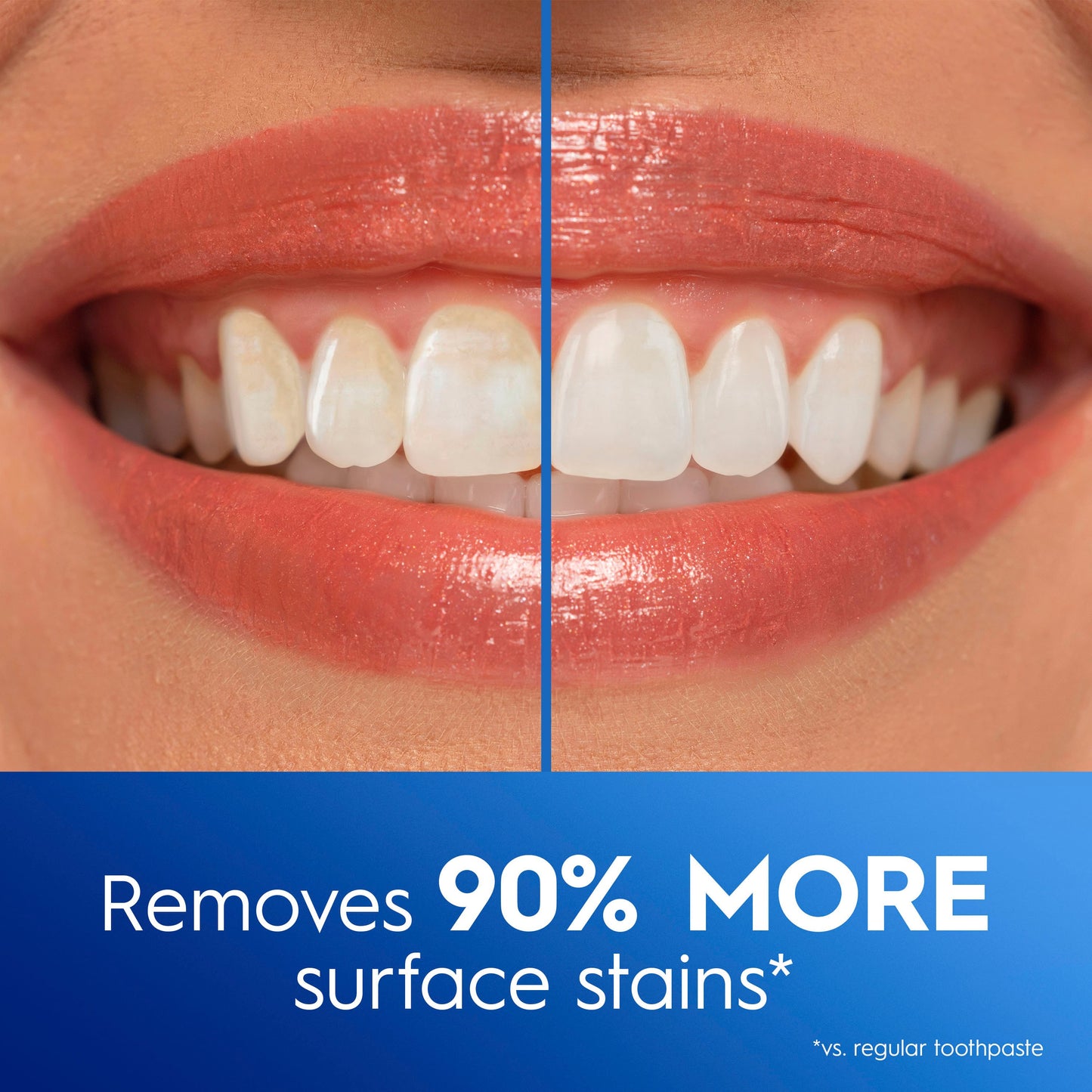Crest 3DWhite Advanced Glamorous White Teeth Whitening Toothpaste