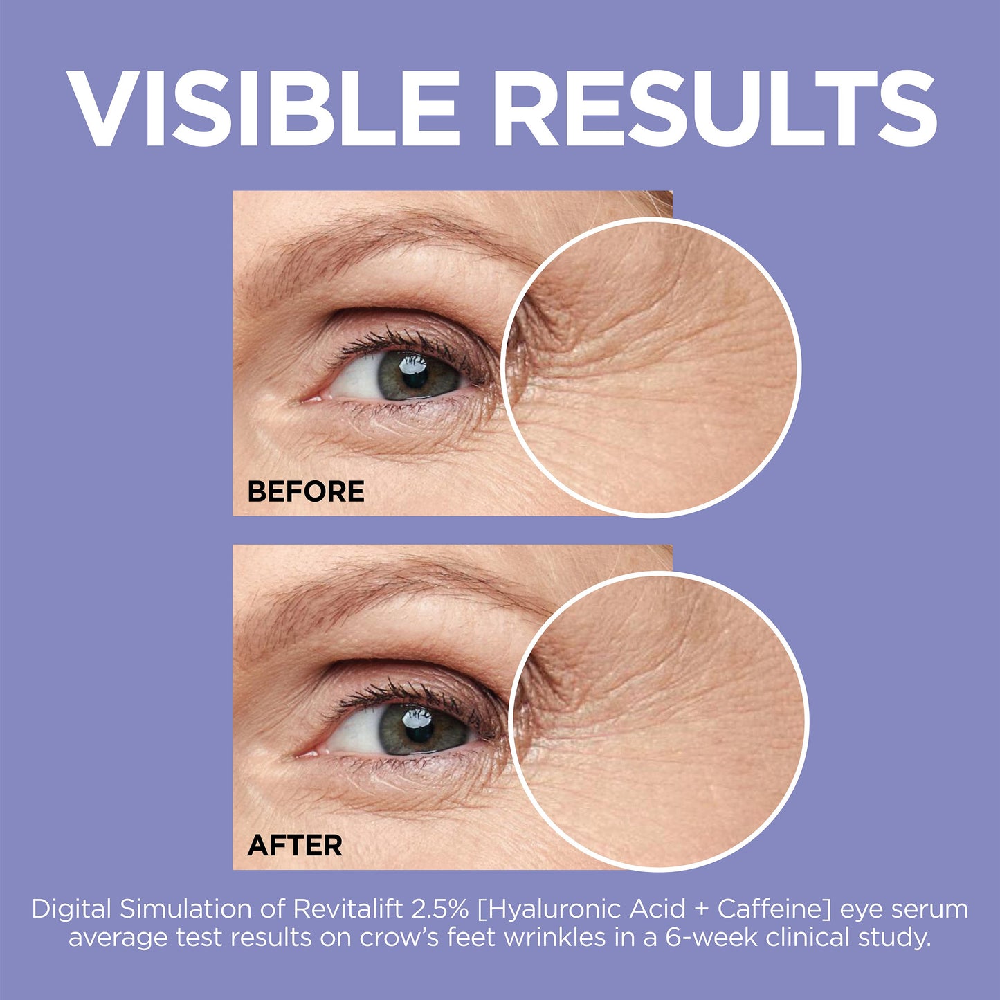 L'Oréal Paris Revitalift Derm Intensives Hyaluronic Caffeine Eye Serum