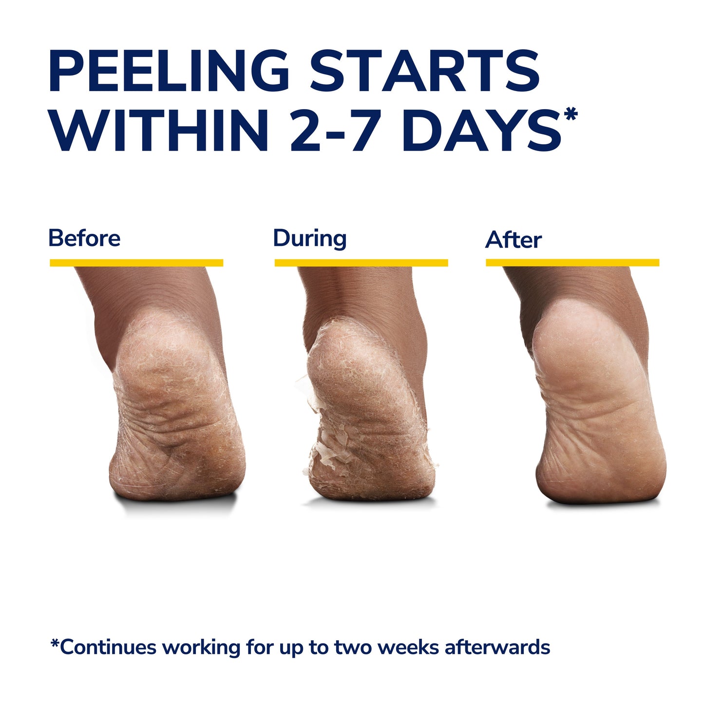 Dr. Scholl's Ultra-Exfoliating Foot Mask