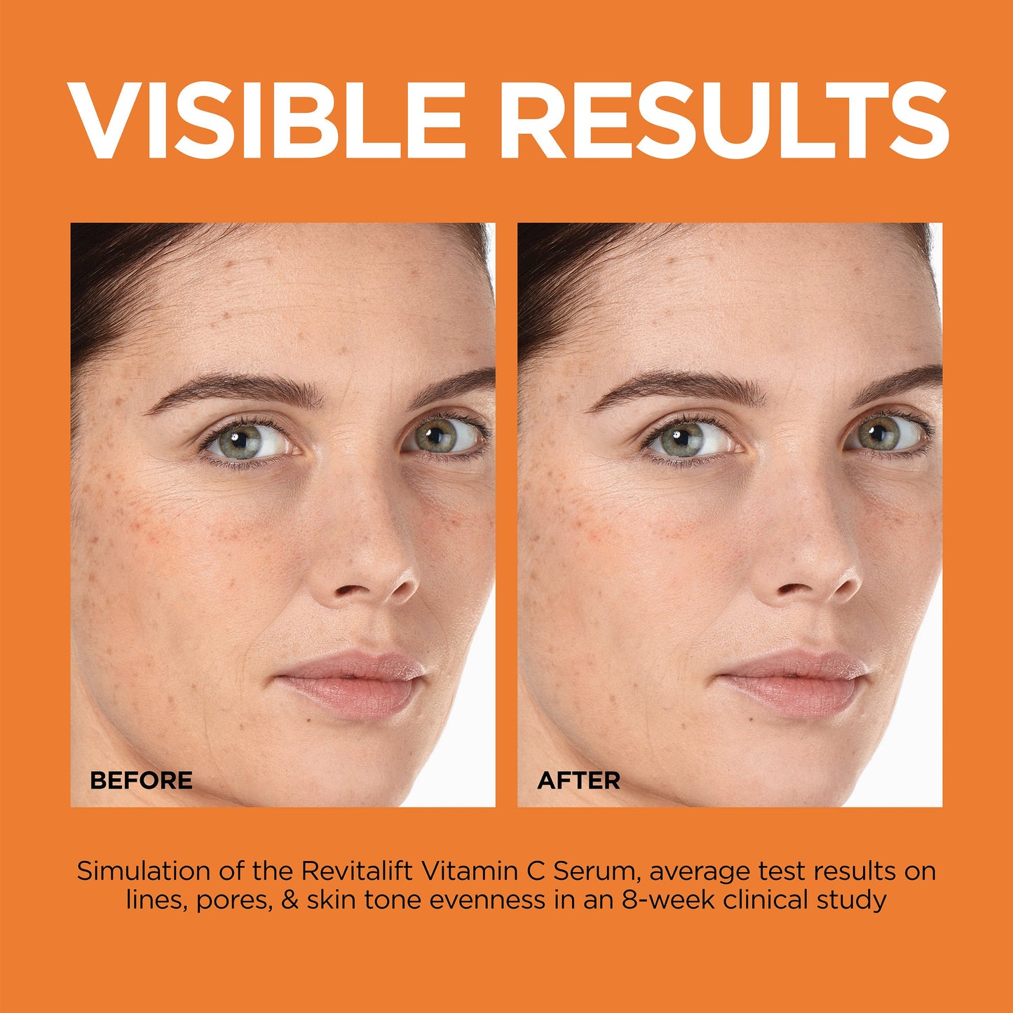 L'Oréal Paris Revitalift Derm Intensives 12% Vitamin C + E + Salicylic Acid Serum