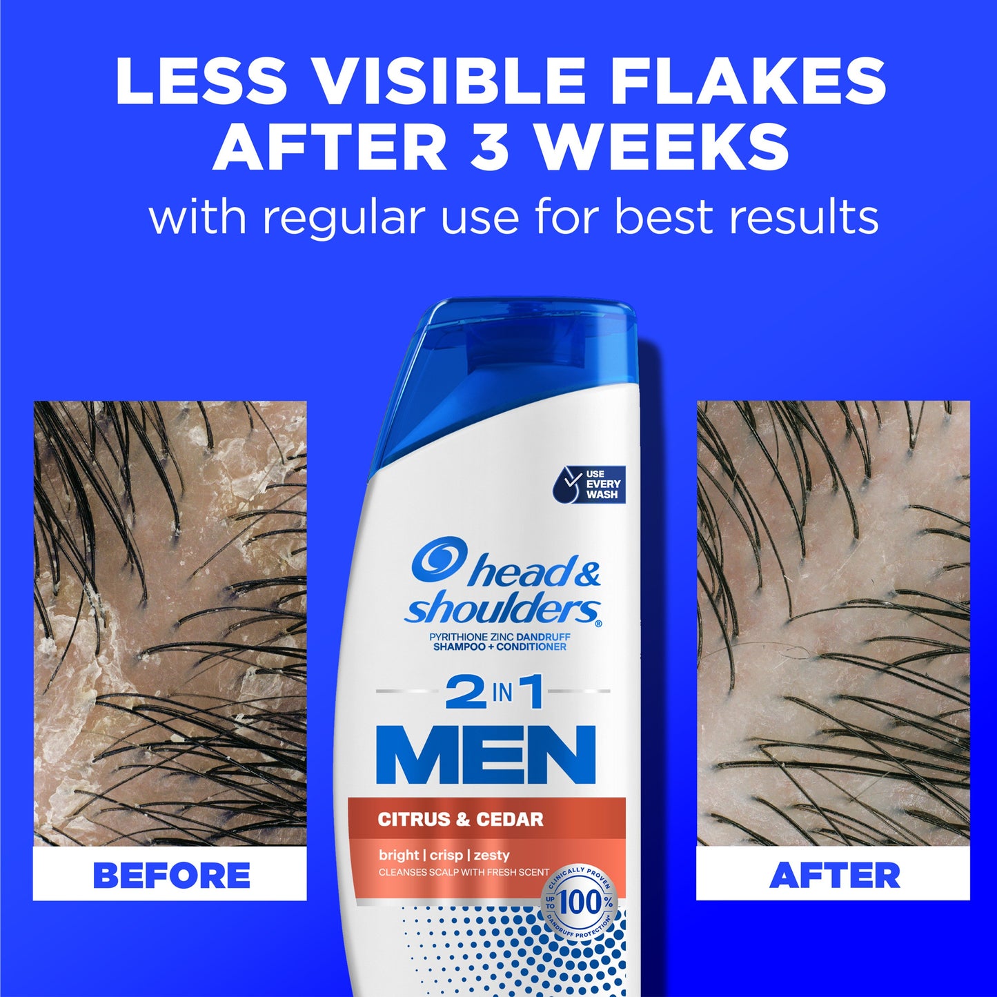 Head & Shoulders 2 in 1 Men Dandruff Shampoo + Conditioner - Eucalyptus & Neem