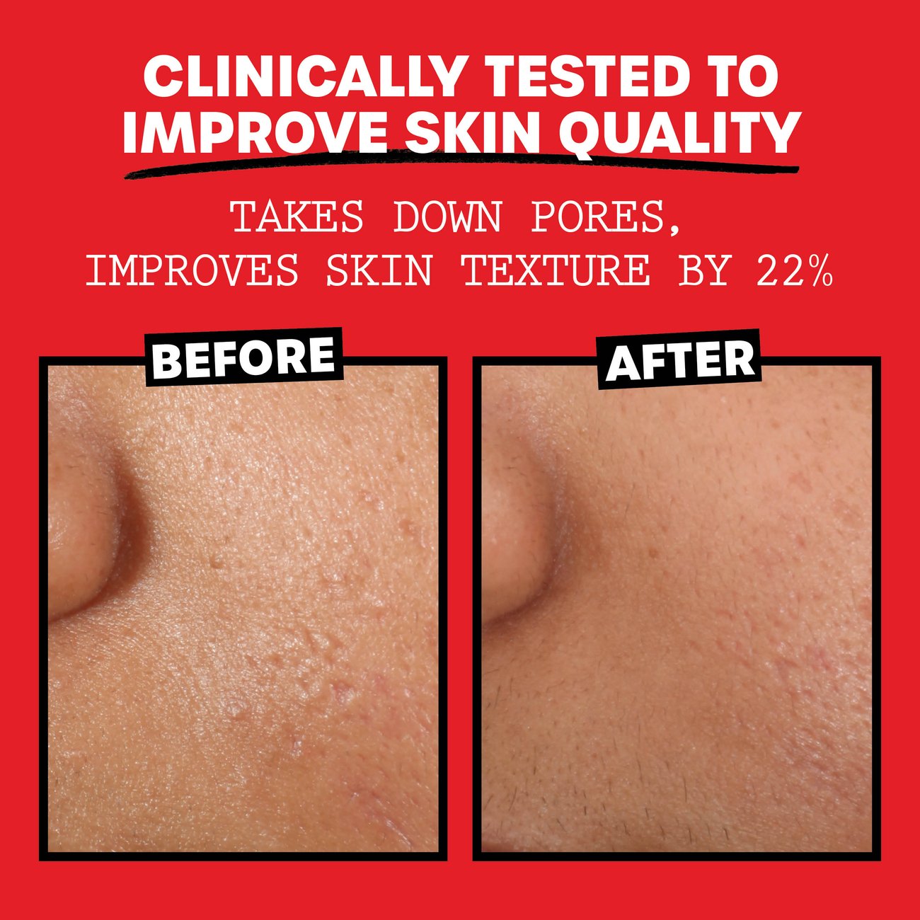 Thayers Witch Hazel Facial Toner - Unscented, Alcohol Free