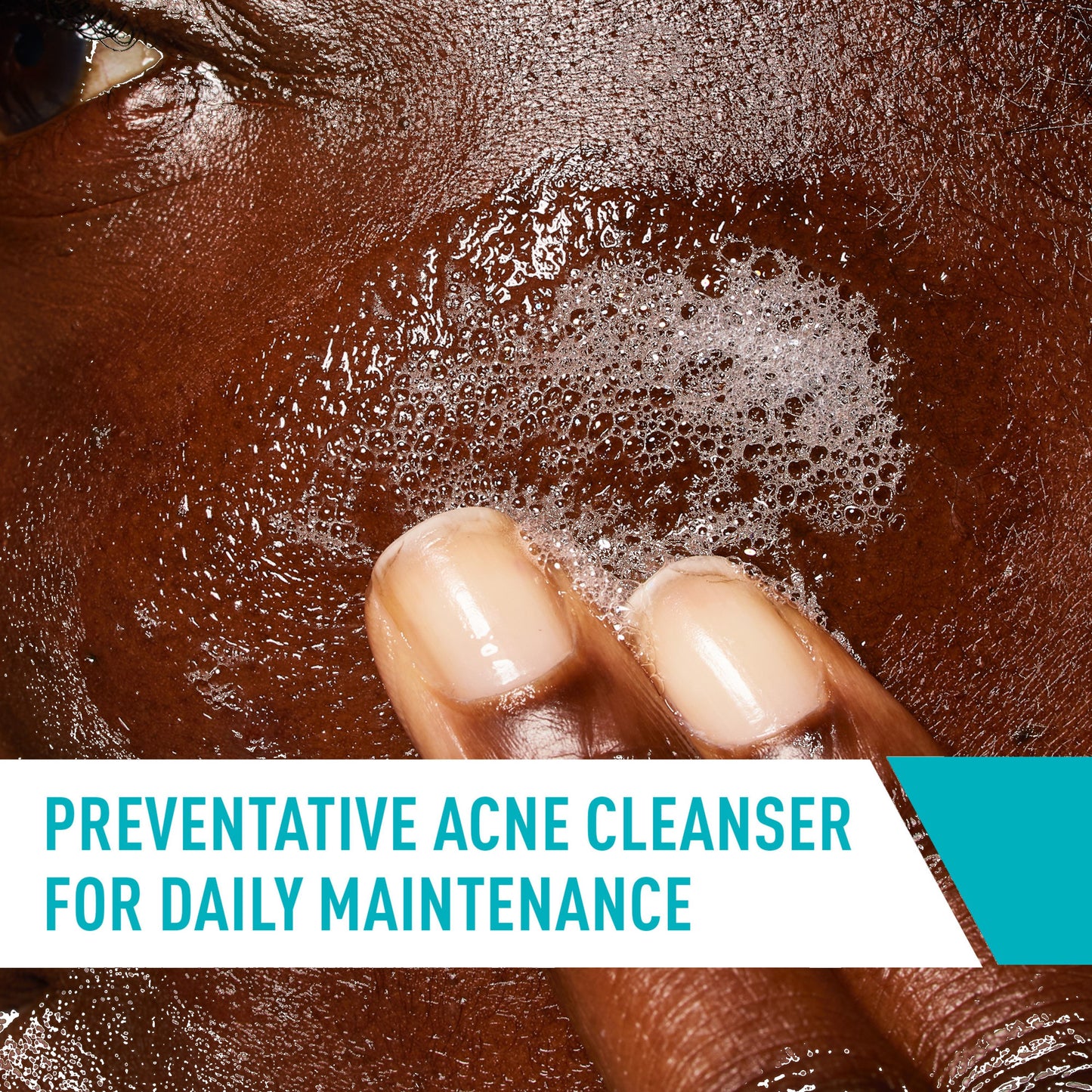 CeraVe Acne Control Cleanser