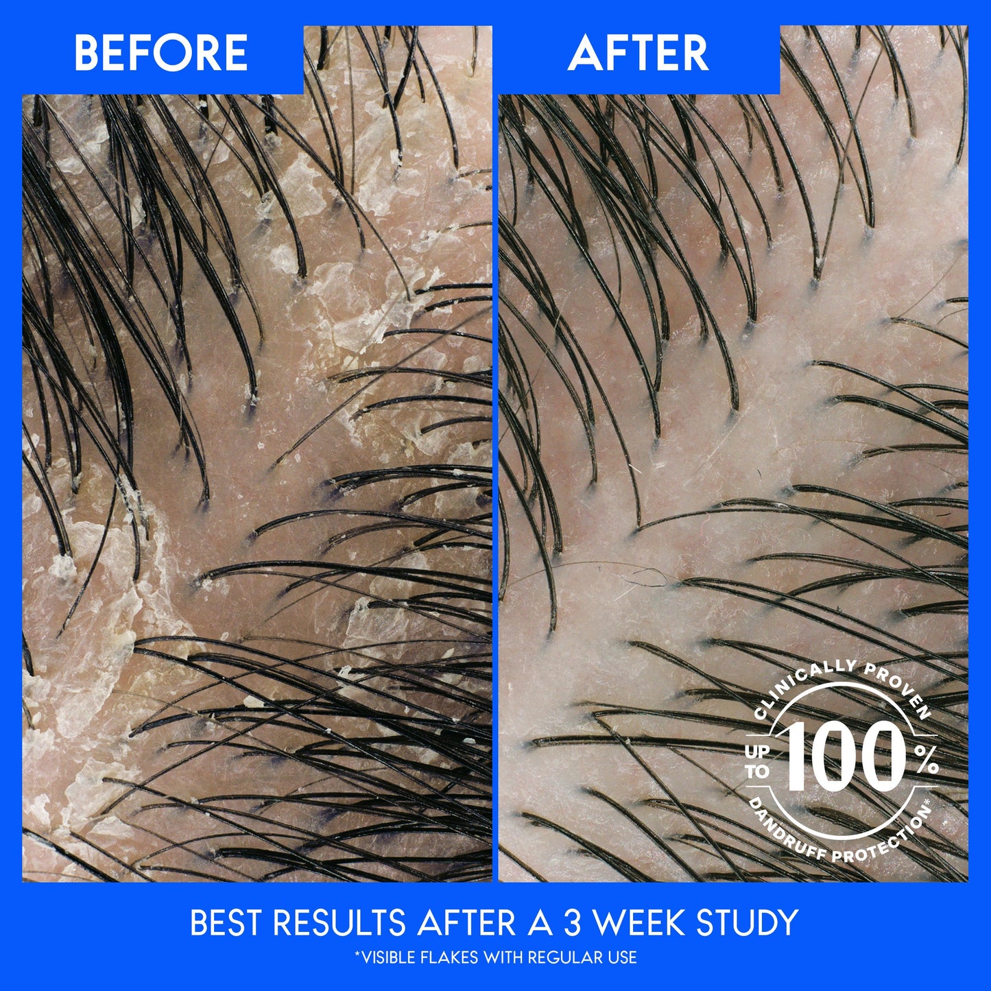 Head & Shoulders Avocado Oil 2 in 1 Shampoo + Conditioner