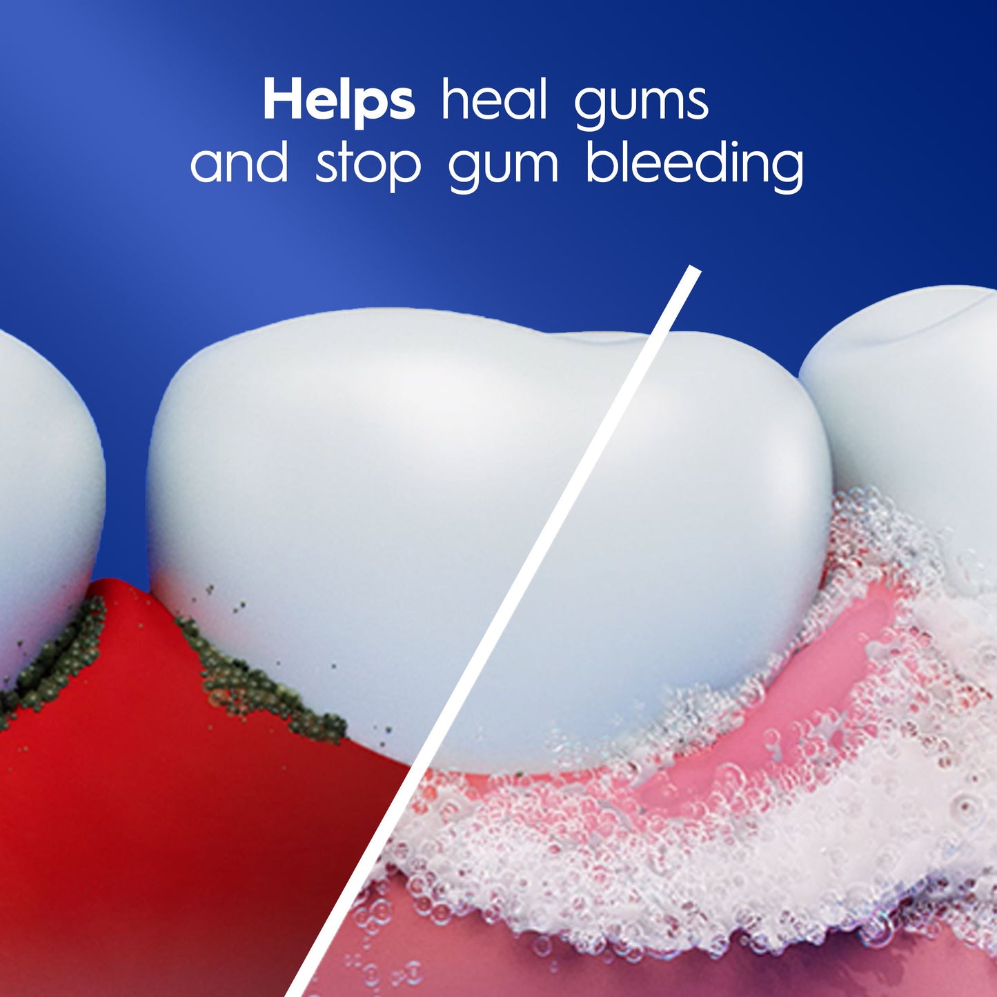 Crest Pro-Health Gum Detoxify & Whitening Toothpaste