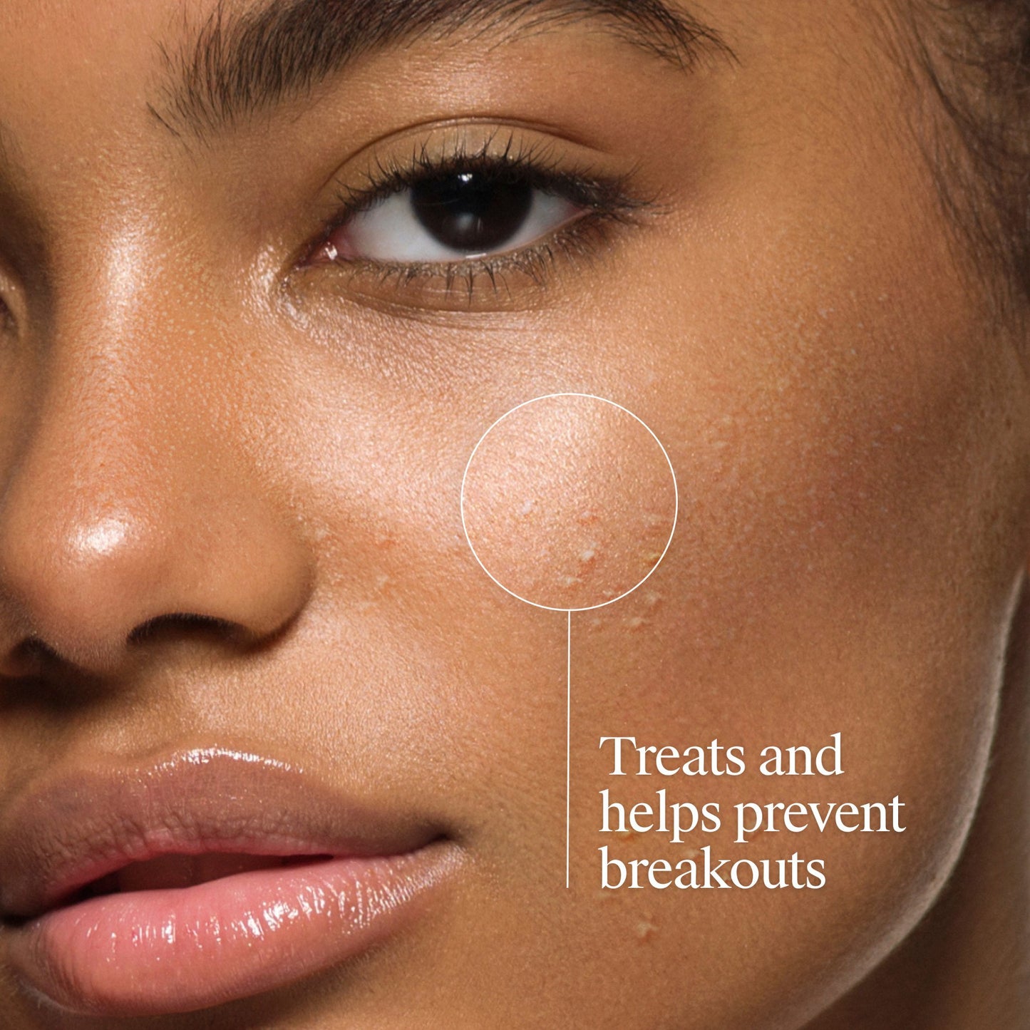 Neutrogena Oil-Free Acne Fighting Face Wash