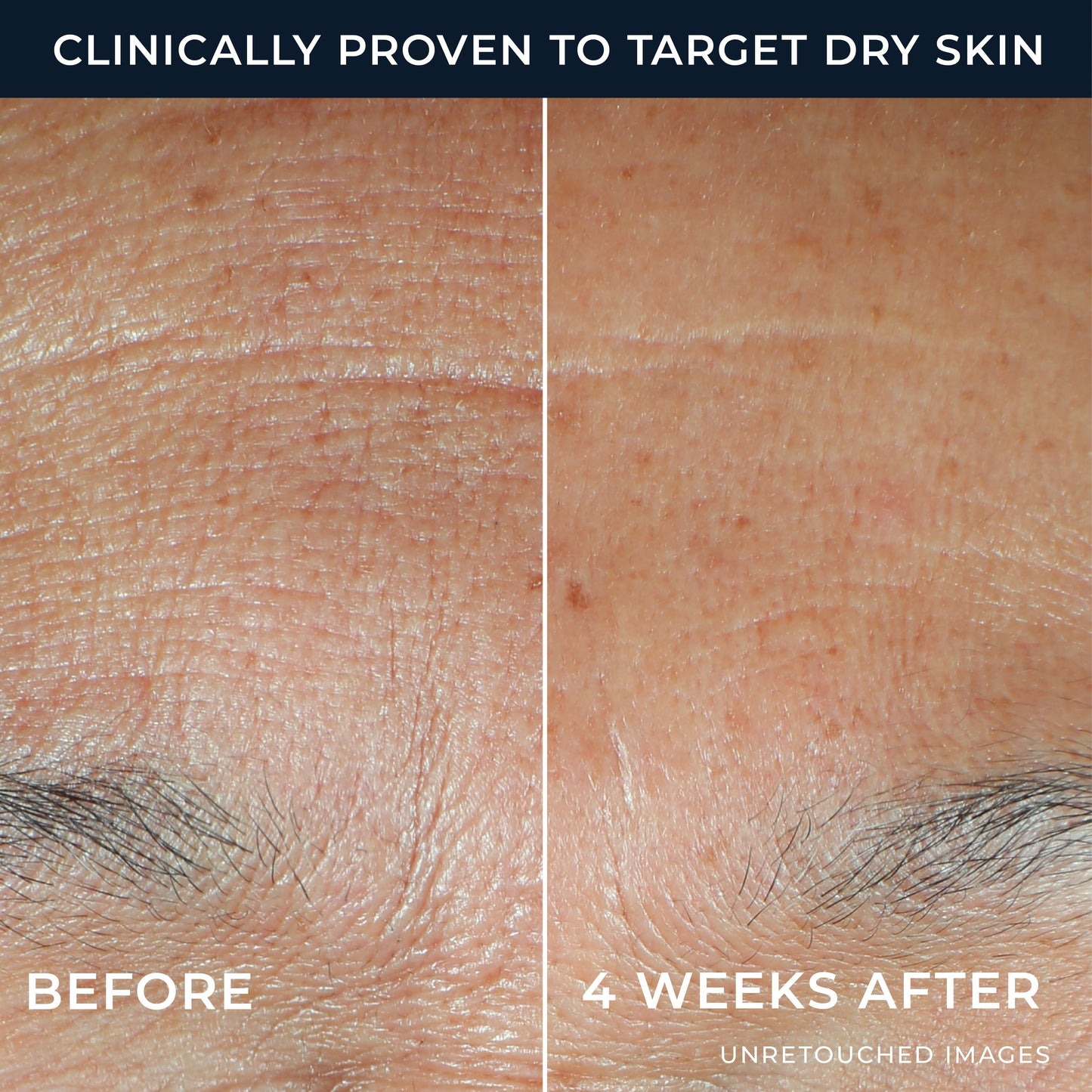 RoC Hyaluronic Acid Hydration+ Serum