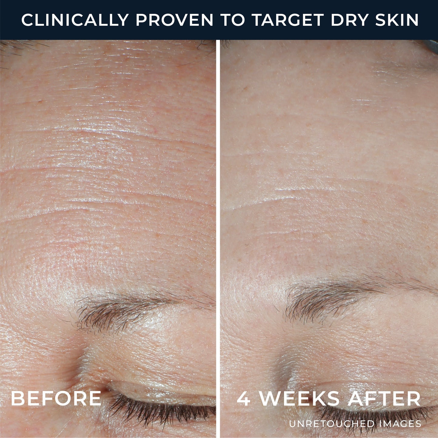 RoC Hyaluronic Acid Hydration+ Moisturizer