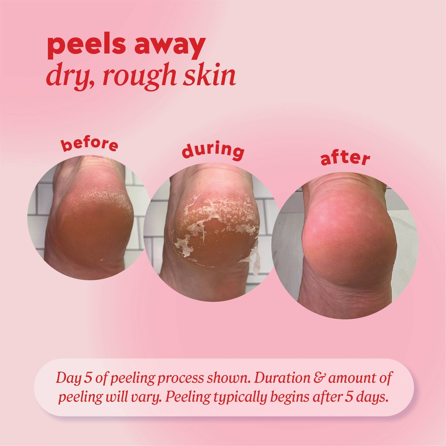 Onyx Professional Bye-EE Calluses Foot Mask