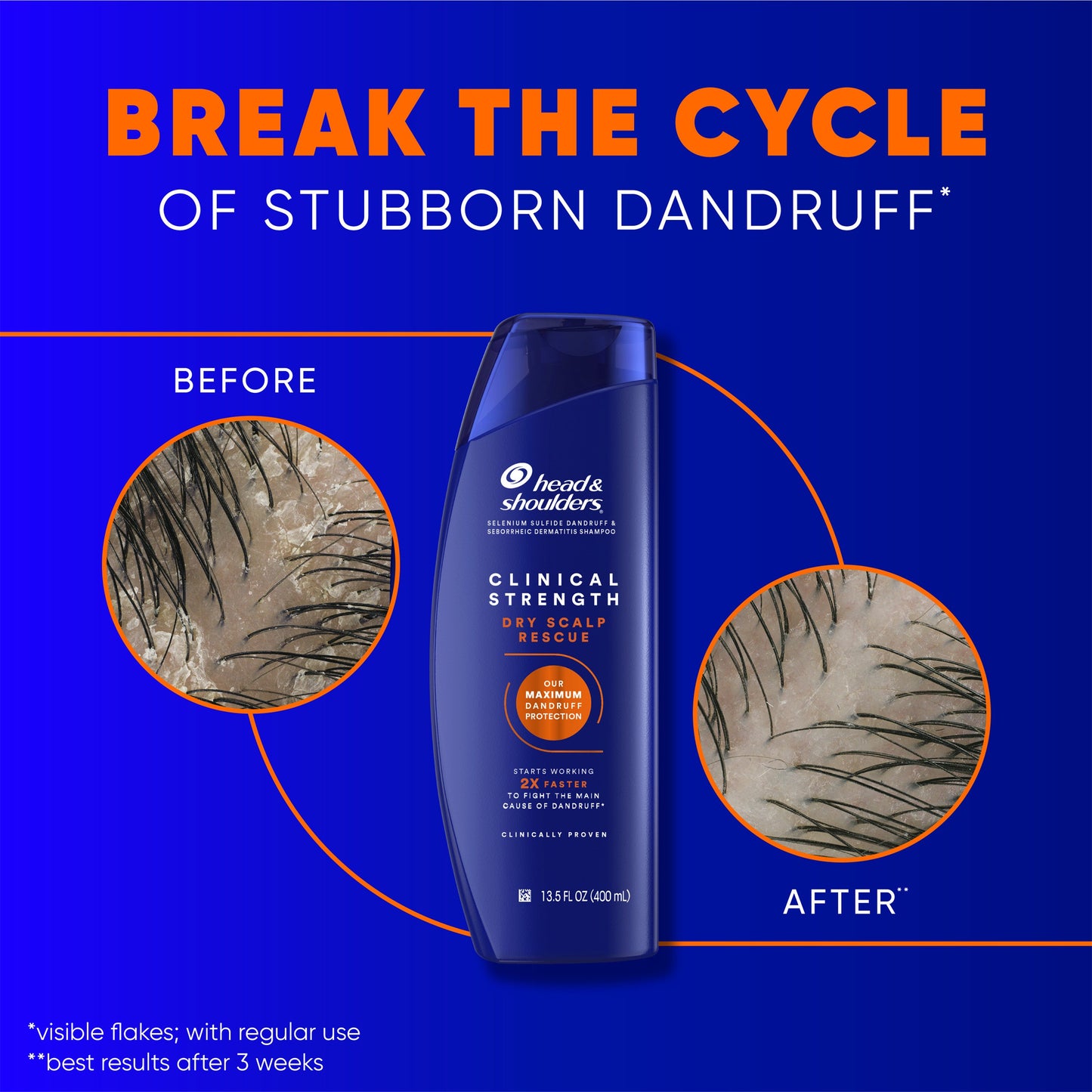 Head & Shoulders Clinical Strength Dry Scalp Rescue Shampoo