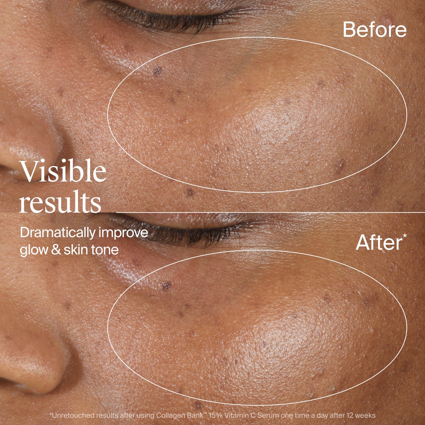 Neutrogena Collagen Bank 15% Vitamin C Booster Serum