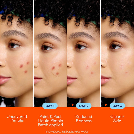 Biore Paint & Peel Liquid Pimple Patch