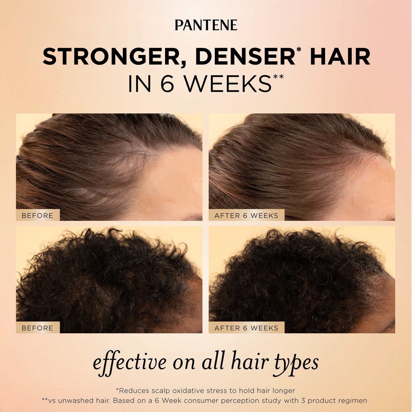 Pantene Abundant & Strong Scalp & Root Serum with Pro-Vitamin B5 Complex and Niacinamide, 2 oz